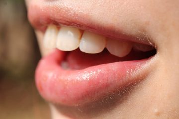 bonne santé des dents